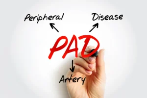 peripheral artery disease treatment Las Vegas Nevada
